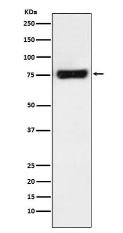 MTA2 Antibody (SR2200), Novus Biologicals 50 &mu;g; Unconjugated:Antibodies,