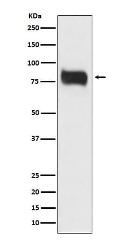 MBD1 Antibody (SR2117), Novus Biologicals 100 &mu;g; Unconjugated:Antibodies,