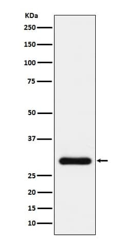 BNP Antibody (SR1505), Novus Biologicals 100 &mu;g; Unconjugated:Antibodies,