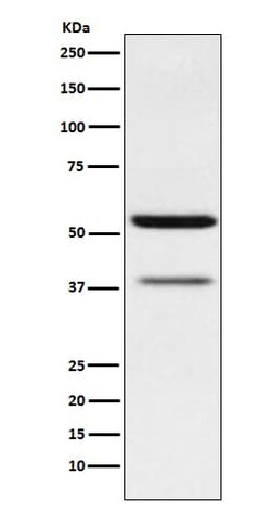 CEACAM6/CD66c Antibody (SR1614), Novus Biologicals:Antibodies:Primary Antibodies