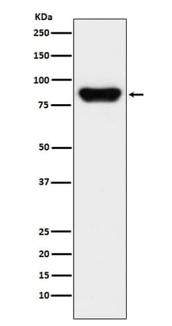 Prothrombin Antibody (SR2163), Novus Biologicals:Antibodies:Primary Antibodies