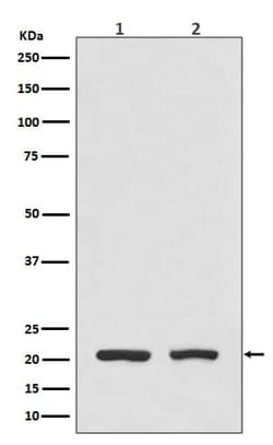 Dihydrofolate Reductase/DHFR Antibody (SR1325), Novus Biologicals:Antibodies:Primary