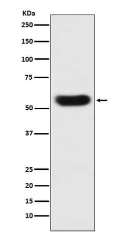 Serpin C1/Antithrombin-III Antibody (SR1949), Novus Biologicals:Antibodies:Primary