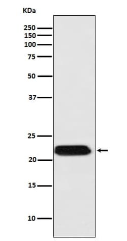 Ferritin mitochondrial Antibody (SR1345), Novus Biologicals 100 &mu;g;