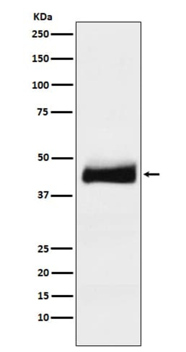 alpha 1Acid Glycoprotein Antibody (SR1818), Novus Biologicals 100 μg