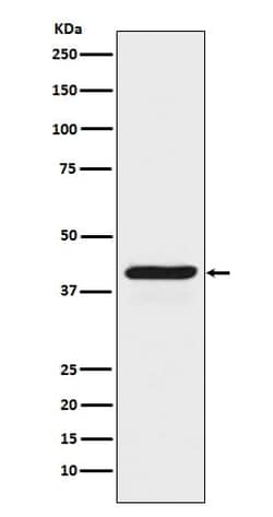 Indoleamine 2,3-dioxygenase/IDO Antibody (SR1771), Novus Biologicals 50