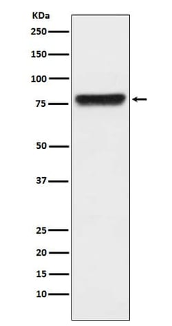 Plasma Kallikrein/KLKB1 Antibody (SR2234), Novus Biologicals 50 &mu;g;