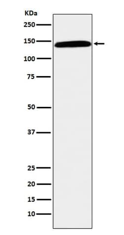 CD42b/GPIb alpha Antibody (SR1163), Novus Biologicals:Antibodies:Primary