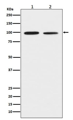 DDR2 Antibody (SR2306), Novus Biologicals:Antibodies:Primary Antibodies