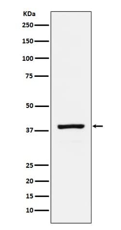 RASSF1 Antibody (SR1658), Novus Biologicals 50 &mu;g; Unconjugated:Antibodies,