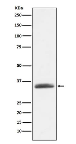alpha 1-Microglobulin Antibody (SR1647), Novus Biologicals:Antibodies:Primary