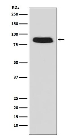 G-CSFR/CD114 Antibody (SR2290), Novus Biologicals 50 &mu;g; Unconjugated:Antibodies,