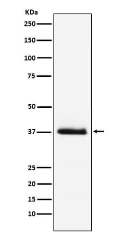 PTH Antibody (SR1601), Novus Biologicals 50 &mu;g | Buy Online | Novus Biologicals | Fisher Scientific