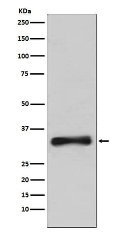 Emerin Antibody (SR1482), Novus Biologicals 100 &mu;g; Unconjugated:Antibodies,