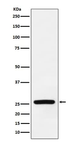 SOD3/EC-SOD Antibody (SR1423), Novus Biologicals:Antibodies:Primary Antibodies