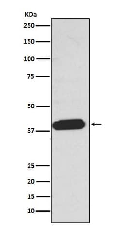 LPAR1/LPA1/EDG-2 Antibody (SR1651), Novus Biologicals 50 &mu;g; Unconjugated:Antibodies,