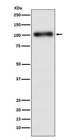 GABA-B R1 Antibody (SR1045), Novus Biologicals 50 &mu;g; Unconjugated:Antibodies,