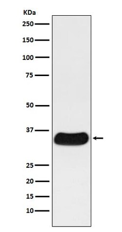 Galectin-4 Antibody (SR1598), Novus Biologicals 100 &mu;g; Unconjugated:Antibodies,