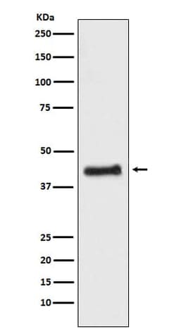 COUP-TF I/NR2F1 Antibody (SR1792), Novus Biologicals 50 &mu;g; Unconjugated:Antibodies,