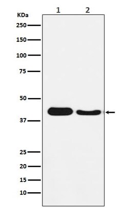 ATG4A Antibody (SR1759), Novus Biologicals 100 &mu;g | Buy Online | Novus Biologicals | Fisher Scientific