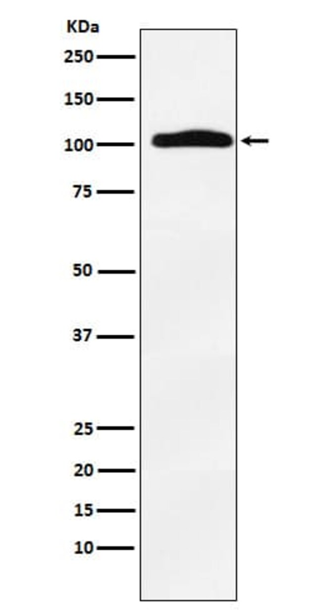Thyroid Peroxidase Antibody (SR1030), Novus Biologicals 50 μg ...