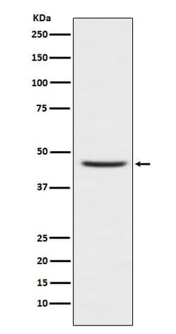 CCR8 Antibody (SR1687), Novus Biologicals 50 &mu;g | Buy Online | Novus Biologicals | Fisher Scientific