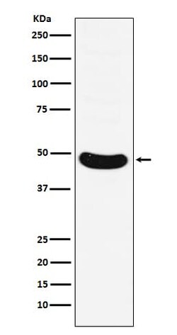 MNX1/HLXB9 Antibody (SR1689), Novus Biologicals:Antibodies:Primary Antibodies
