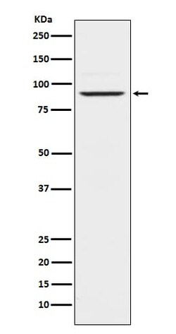 Prolactin R Antibody (SR2303), Novus Biologicals 50 &mu;g; Unconjugated:Antibodies,
