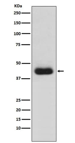 CD82/Kai-1 Antibody (SR1500), Novus Biologicals:Antibodies:Primary Antibodies