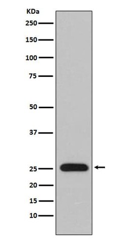 Lambda Light Chain Antibody (SR1399), Novus Biologicals:Antibodies:Primary