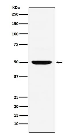 IRF4 Antibody (SR1924), Novus Biologicals:Antibodies:Primary Antibodies