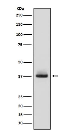 Glycophorin A Antibody (SR1637), Novus Biologicals 100 &mu;g | Buy Online | Novus Biologicals | Fisher Scientific