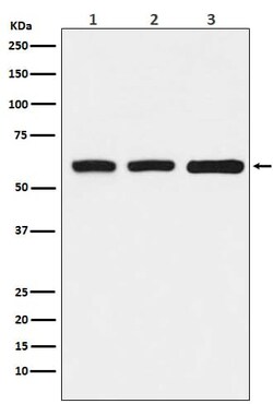 Elp3 Antibody (SR2083), Novus Biologicals 50 &mu;g; Unconjugated:Antibodies,