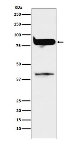 PKC eta Antibody (SR1663), Novus Biologicals 100 &mu;g; Unconjugated:Antibodies,