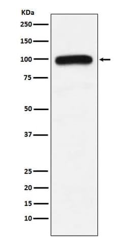 E6AP/UBE3A Antibody (SR1023), Novus Biologicals:Antibodies:Primary Antibodies