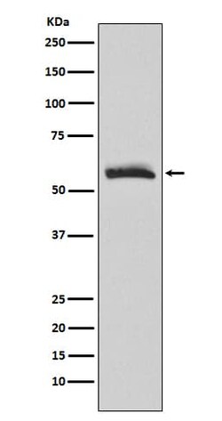 Muscarinic Acetylcholine Receptor M3/CHRM3 Antibody (SR2111), Novus Biologicals