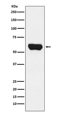 Lck Antibody (SR2027), Novus Biologicals:Antibodies:Primary Antibodies