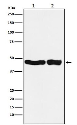UQCRC2 Antibody (SR1848), Novus Biologicals:Antibodies:Primary Antibodies