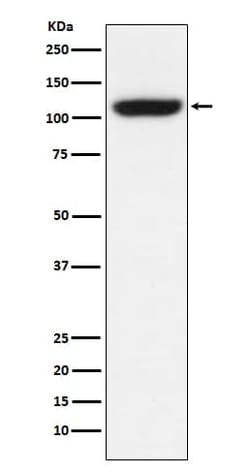 TRPM8 Antibody (SR1110), Novus Biologicals 100 &mu;g; Unconjugated:Antibodies,