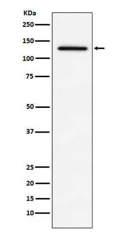MDA5 Antibody (SR1076), Novus Biologicals:Antibodies:Primary Antibodies