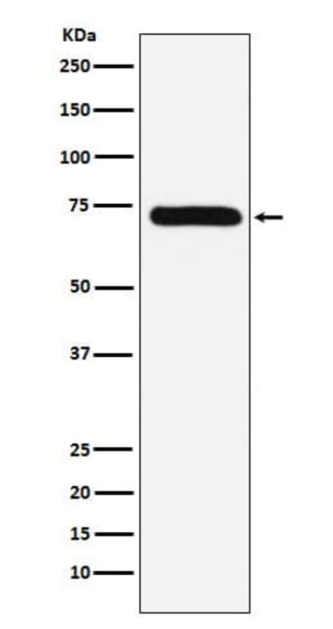Coagulation Factor X Antibody (SR2185), Novus Biologicals 100 μg