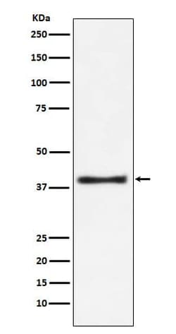 Aspartate Aminotransferase Antibody (SR1790), Novus Biologicals:Antibodies:Primary