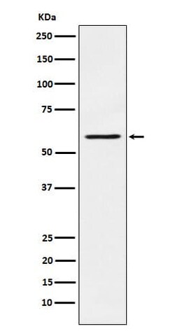 PAK1 Antibody (SR2113), Novus Biologicals:Antibodies:Primary Antibodies