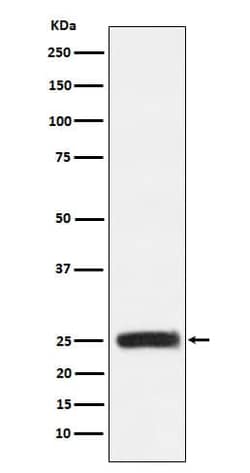 GRB2 Antibody (SR1396), Novus Biologicals 100 &mu;g, Unconjugated:Antibodies,