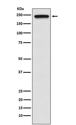 TRPM7 Antibody (SR1322), Novus Biologicals 100 &mu;g, Unconjugated:Antibodies,