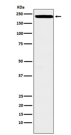 ZEB1 Antibody (SR1312), Novus Biologicals:Antibodies:Primary Antibodies