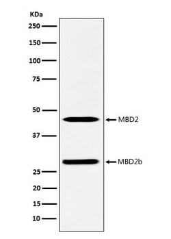 MBD2 Antibody (SR1478), Novus Biologicals:Antibodies:Primary Antibodies