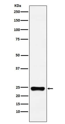 BAG2 Antibody (SR1374), Novus Biologicals 100 &mu;g; Unconjugated:Antibodies,