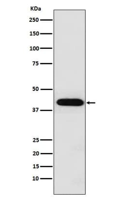Inhibin alpha Antibody (SR1672), Novus Biologicals:Antibodies:Primary Antibodies