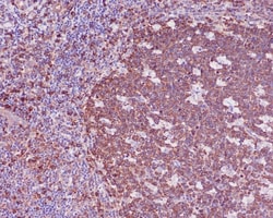 beta I Tubulin Antibody (SR1866), Novus Biologicals 50 &mu;g; Unconjugated:Antibodies,